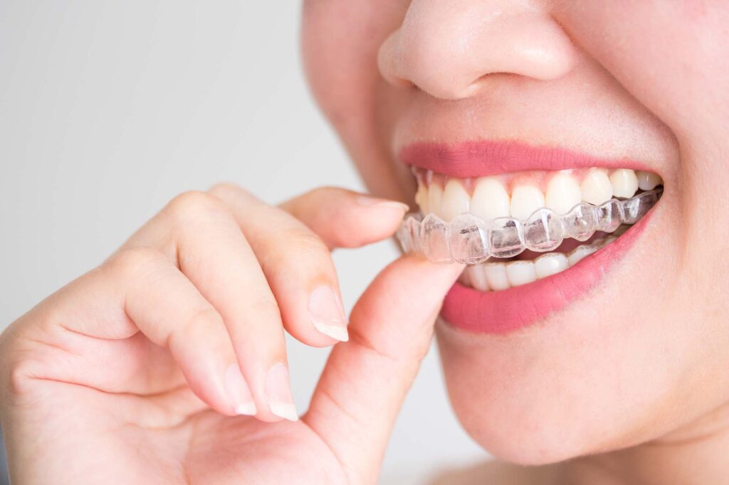 A smiling woman holding invisalign or invisible braces, orthodon