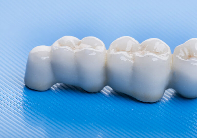 ceramic crowns - in a dental laboratory